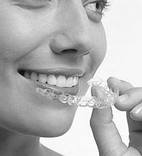 Invisalign